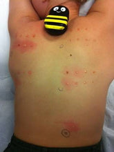 Carregar imagem no visualizador da galeria, Buzzy Personal Abelha - Buzzy Medical